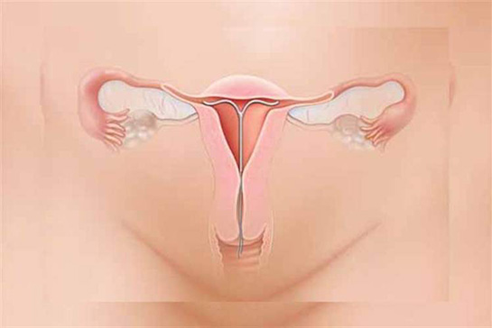 Rahim Enfeksiyonu Belirtileri ve Tedavisi